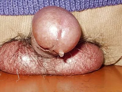 Verpleegkundige spijkeren video (Victoria gratis sex filmpjes kijken Lawson)